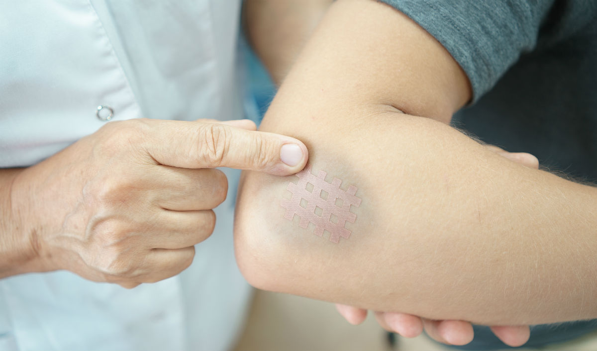 6 Surprising Reasons Why You’re Always Black And Blue